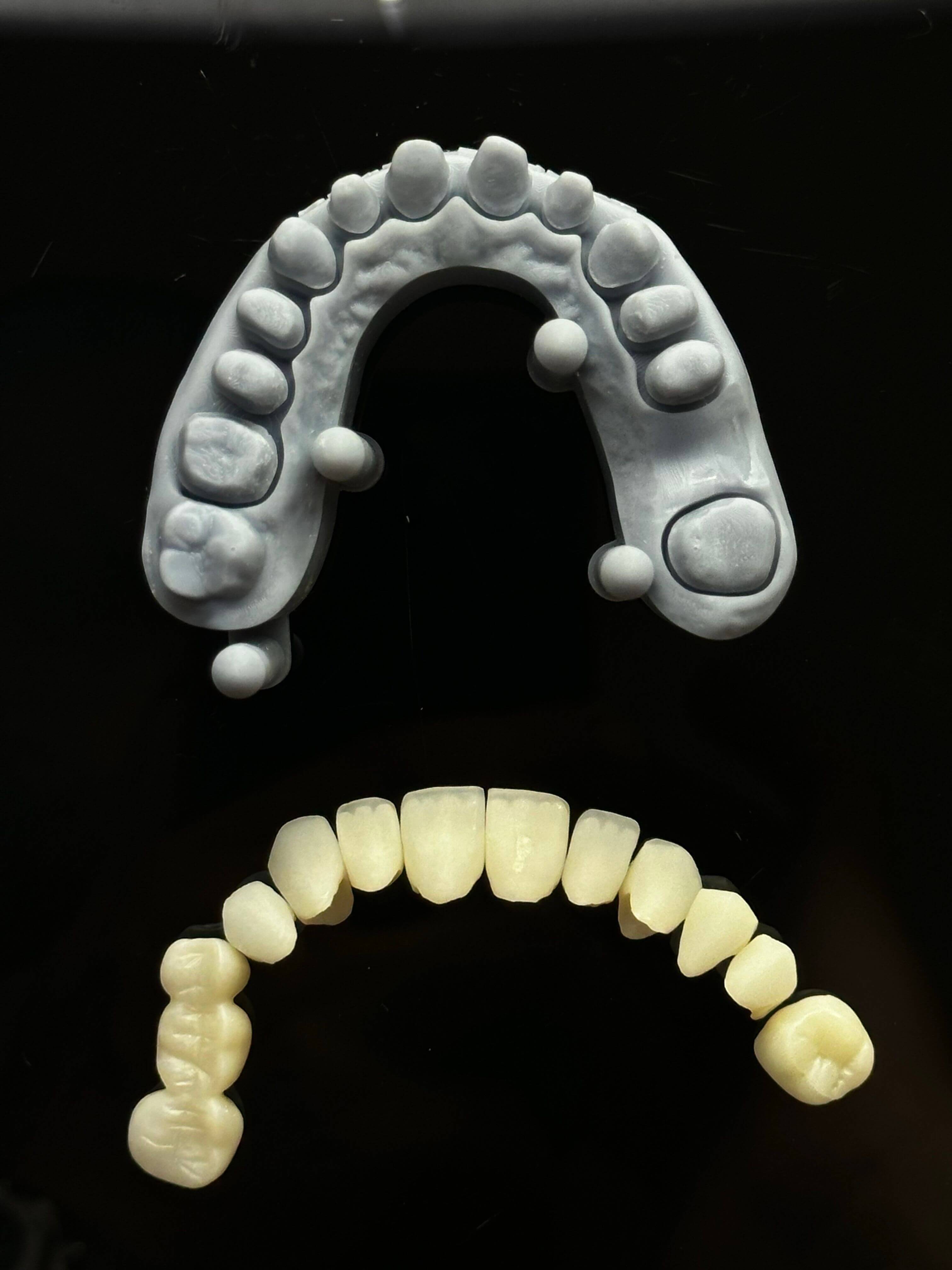 3D-printed dental arch model alongside a ceramic prosthetic set